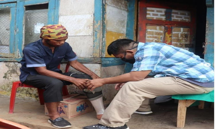 Bantuan Kaki Palsu dan Tangan Palsu untuk Warga Difabel di Kab. Subang