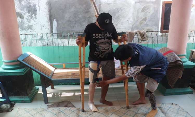 Hidup sebagai penyandang disabilitas Bakrie Amanah berikan bantuan kaki palsu untuk Bapak Omay Surya