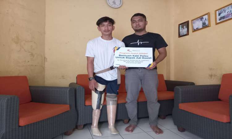 Program penyaluran kaki palsu untuk adi rosidi